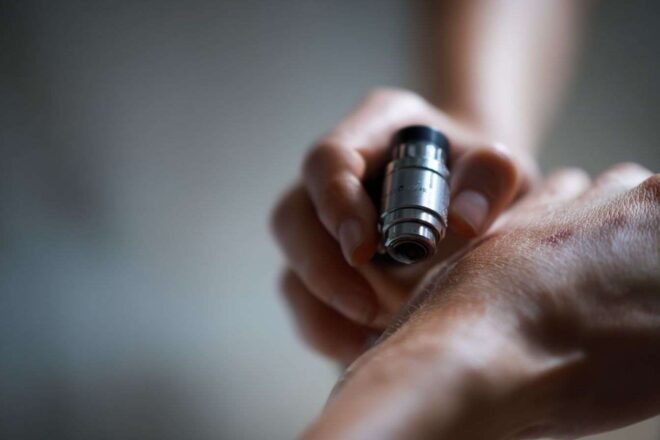 Dermatologue tenant un dermatoscope