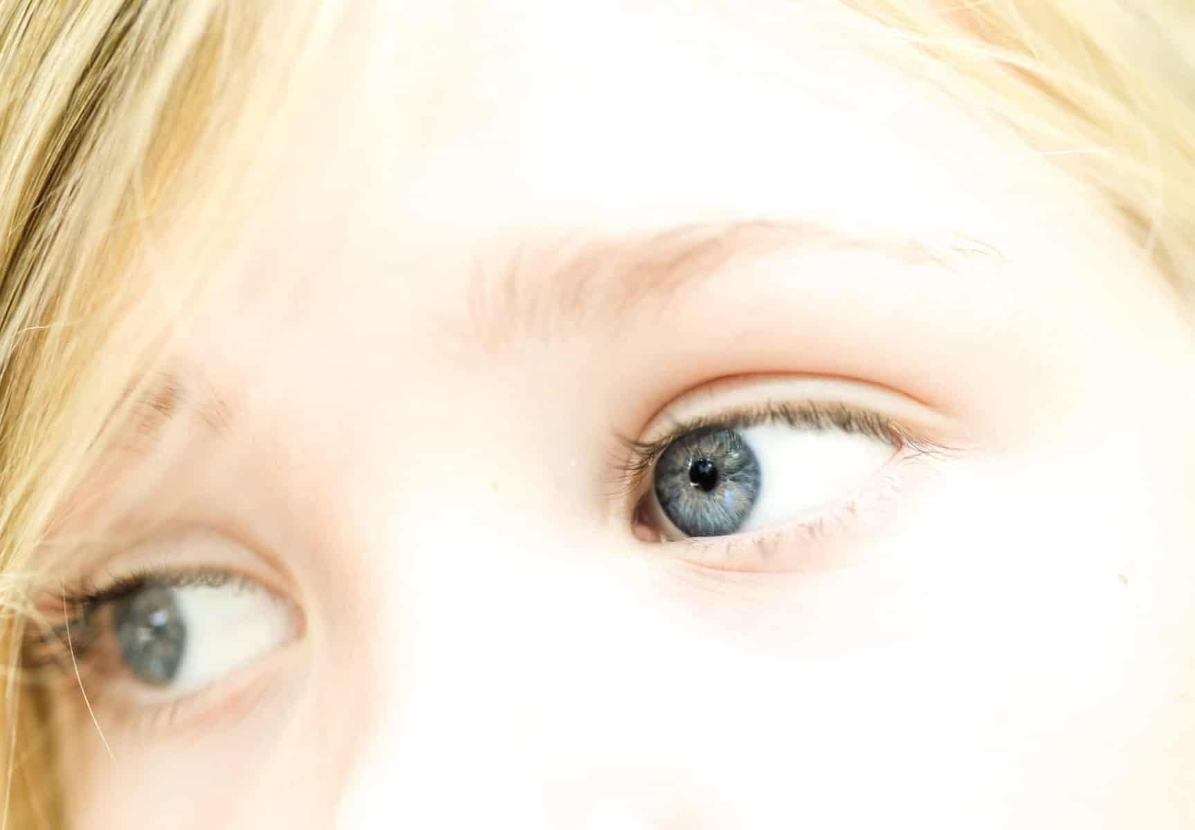 Photo d'illustration. Des yeux.