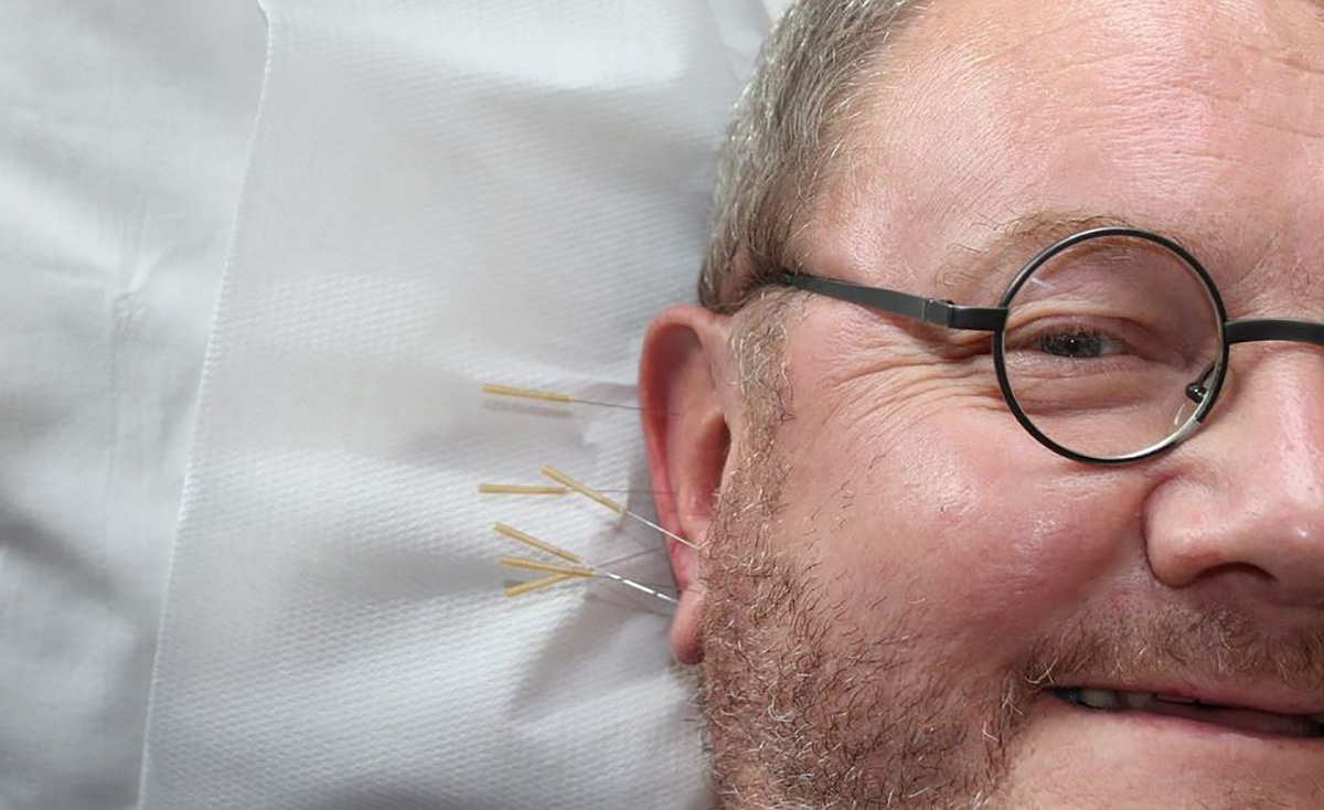 Acupuncture oreille